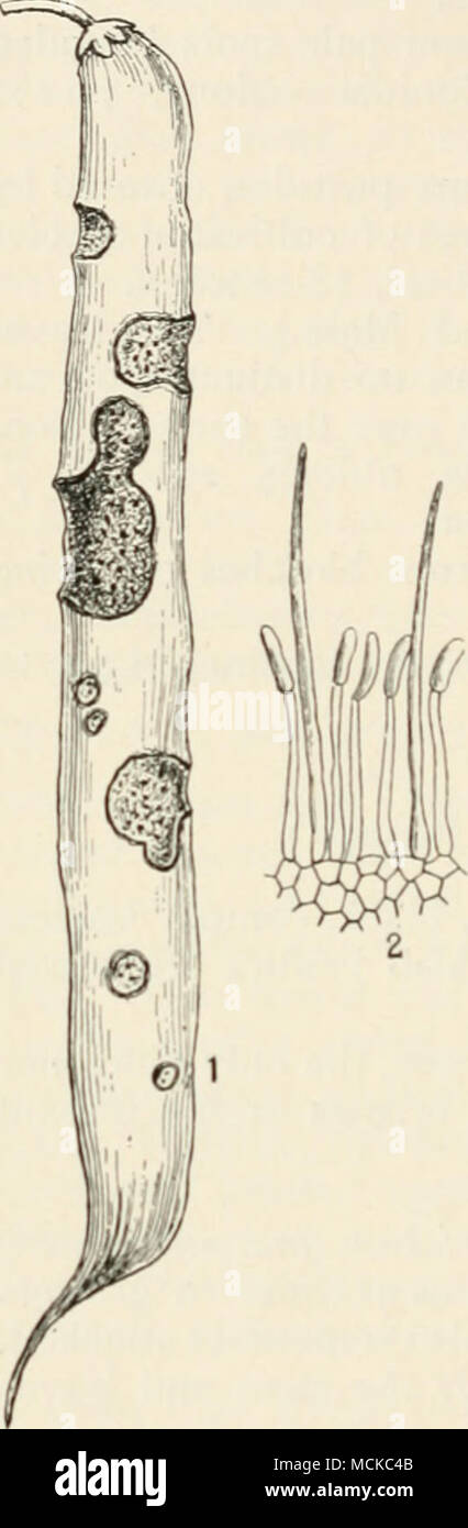 . Fig. Tfi.—CoUetotrkhu)Hlimit- muthianuiH. i, diseased pod of scarlet-runner ; 2, section through a pustule of the fungus showing conidiophores bearing conidia at their tips, also two long, sterile spines, which should have been dark in colour, highly mag. Halsted, p. 246. Massee, 1898. Voglino, Fungidannosi alle Fiante Coltivaie, pi. 8. Torny Bot., 20, Gard. C/iro/t., May 7, Witches' brooms of cacao.—In 1900 Ritzema Bos announced the presence of a serious disease of the cacao-tree, which appeared under the guise of witches' brooms, which he attributed to a fungus he named Fxoascus ihcobroma Stock Photo