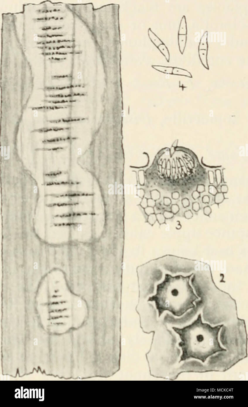 . FiG. 133.—Ascochytaaspidistrac. i, on portion of a leaf of.ispuiis/ra liirida ; 2, perithecia of the fungus bursting through the e|3iderniis of the leaf, mag; 3, section of a peritheciuni, mag ; 4, spores, higlily mag. ing minute cavities with a raised border. The conidia are very numerous, hyaline, elliptic-oblong, i-septate, smooth, 18-24x5-7 /x. Diseased portions should be removed and burned. ASCOCHYTA (Lir..) Perithecia minute, generally immersed in the substance of bleached spots on leaves or twigs, with a terminal pore; i-septate, hyaline. Stock Photo