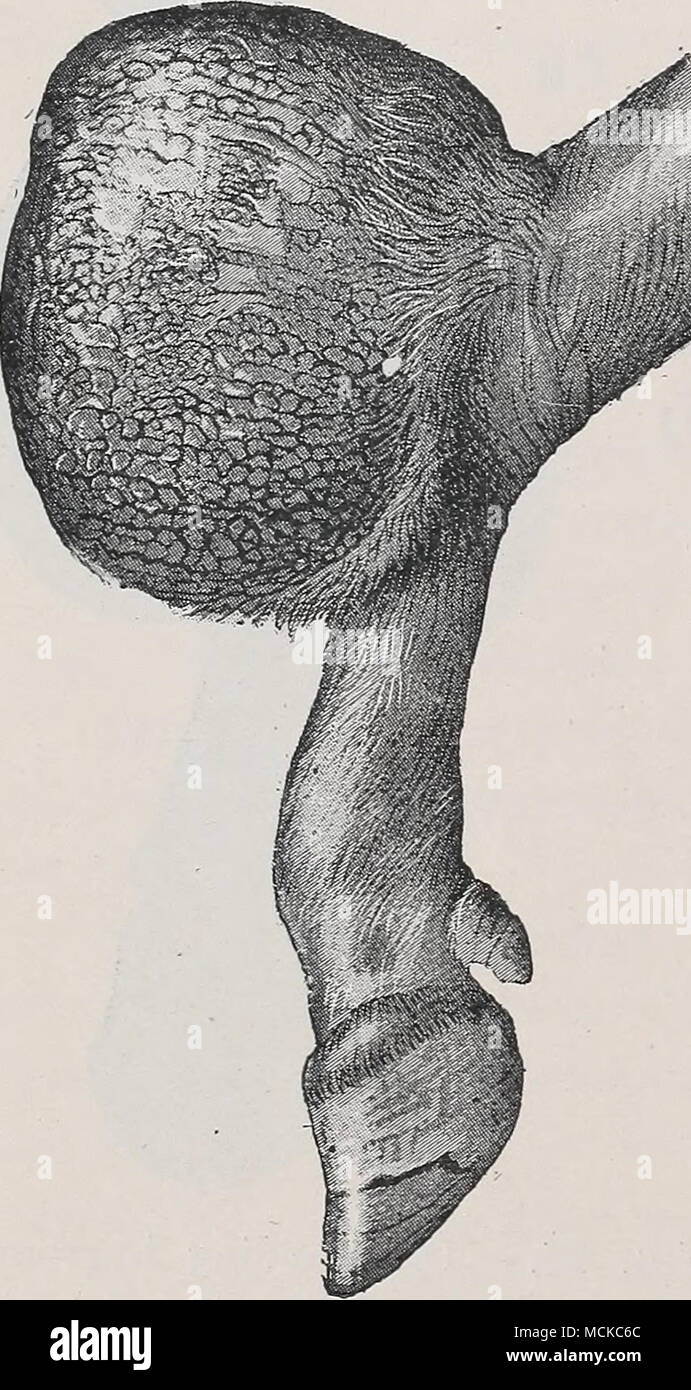 . Fig. 26.^—Hj^groma of the knee. The skin has undergone conversion into a substance resembling horn. Stock Photo