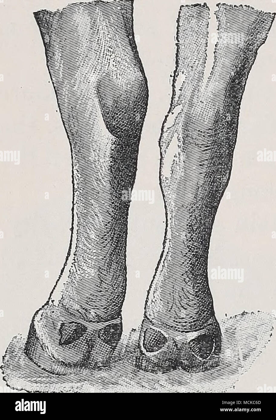 . This hygroma usually results from blows with the ox-goad, which cause inflammation of the subcutaneous connective tissue and cedematous infiltration extending down the leg. Afterwards the slightest Fig. 27.—Capped hock. Stock Photo