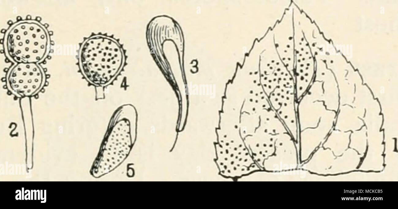. Fig. 90.—Piicciniapruni. i, portion of diseased plum leaf; 2, teleutospore ; 3, paraphysis ; 4, lower cell and portion of pedicel of a teleutospore, from which the upper cell has broken away ; 5, uredospore. Fig. i reduced, remainder highly mag. nature of the various kinds of reproductive bodies produced by this species has existed until recently, when the matter has been thoroughly worked out and put right by Professor M'Alpine. Uredospores varying from almost globose to piriform, smooth, apex conspicuously thickened, 18-36 X 14-18^1; para- physes numerous. Teleutospores formed of two almos Stock Photo