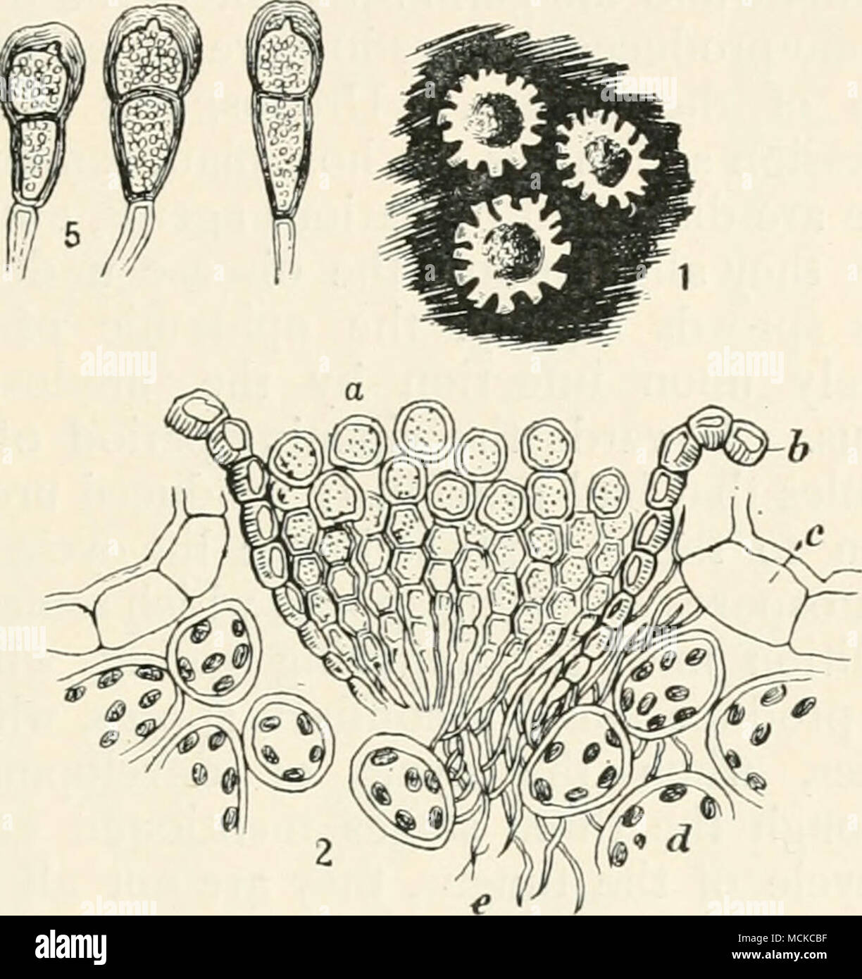. Fig. 88.—Puccinia pringshcimiana. i, portion of gooseberry leaf with three aecidia or ' cluster-cups ' ; 2, section through a ' cluster-cup'; a, spores produced in chains; b, wall or peridium ; c, epidermis of host; rf, middle cells of leaf; e, mycelium of fungus ; 3, portion of sedge leaf bearing sori of teleutospores ; 4, portion of same ; 5, teleutospores. 6, uredo- spores. Fig. i nat. size, and remainder variously mag. thickened, roundish or truncate, base often narrowed, smooth, brown, 35-50 x 15-20 /x; pedicel rigid, persistent. No remedial measures known. It is advisable to pick infec Stock Photo