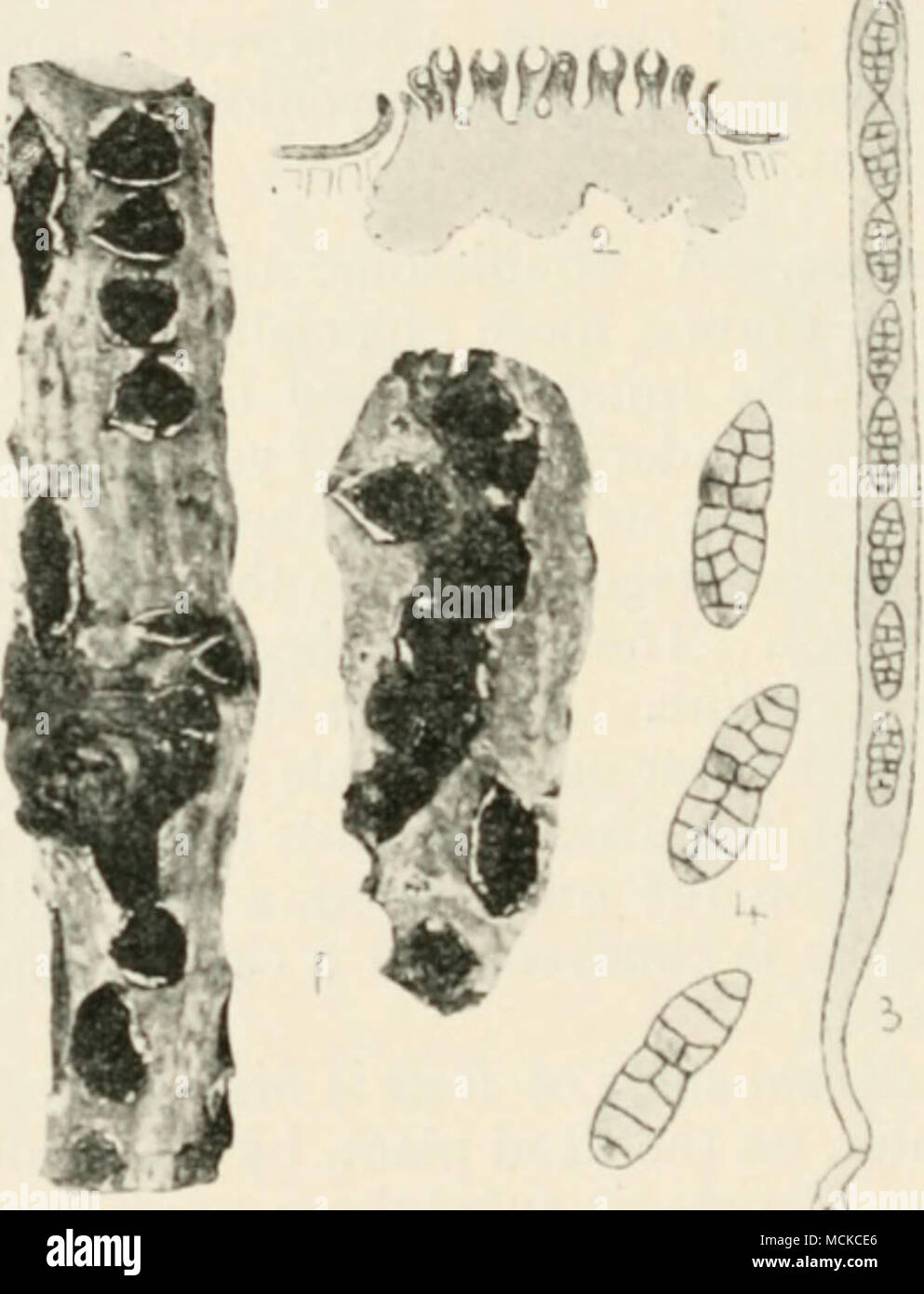 . Fig. 70.—Cuciirbilariii lahiiini. i, branches showing the fungus ; 2, stroma in section, with perithecia; 3, ascus containing spores; 4, free spores. Fig. i nat. size ; remainder highly mag. cylindrical, 8-sporcd, spores elongated, muriform, coloured ; paraphyses numerous. Silver fir canker.Dr. Cavara has described in detail ;i disease of Ahies pcctinata caused by Cucurhitaria pithyophila (De Not., var. ceml&gt;rae, Rehm.). Trees are attacked up to the age of sixty years, but younger trees are most susceptible. Stock Photo