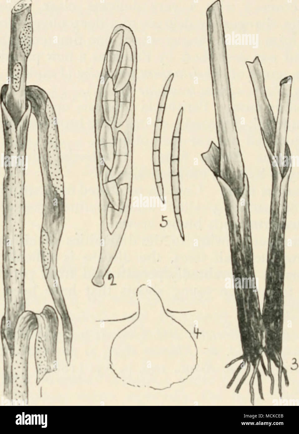 . Fig. 69. —I, Gibellina cenalis on wheat plant, nat. size; 2, ascuh with spores of same, highly mag ; 3, Ophiobolus graminis, on wheat plant, nat. size ; 4, perithecium of same, mag ; 5, spores of same, highly mag. dying, so that the car does not escape from the sheath, or at best is but imperfectly developed. At this stage numerous perithecia are developed on the leaves, leaf-sheaths, and internodes of the stem on those portions previously occupied by the greyish mycelium, but are usually most abundant, and often confined to the inner surface of the leaf-slieaths. Perithecia globose, sunk in Stock Photo