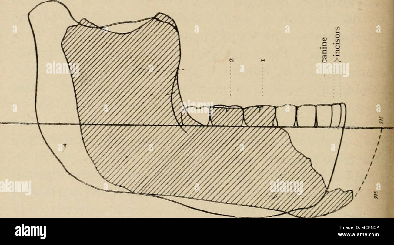 . Fig. 25.—The Piltdown Jaw (shaded) and the Heidelberg Jaw (outline