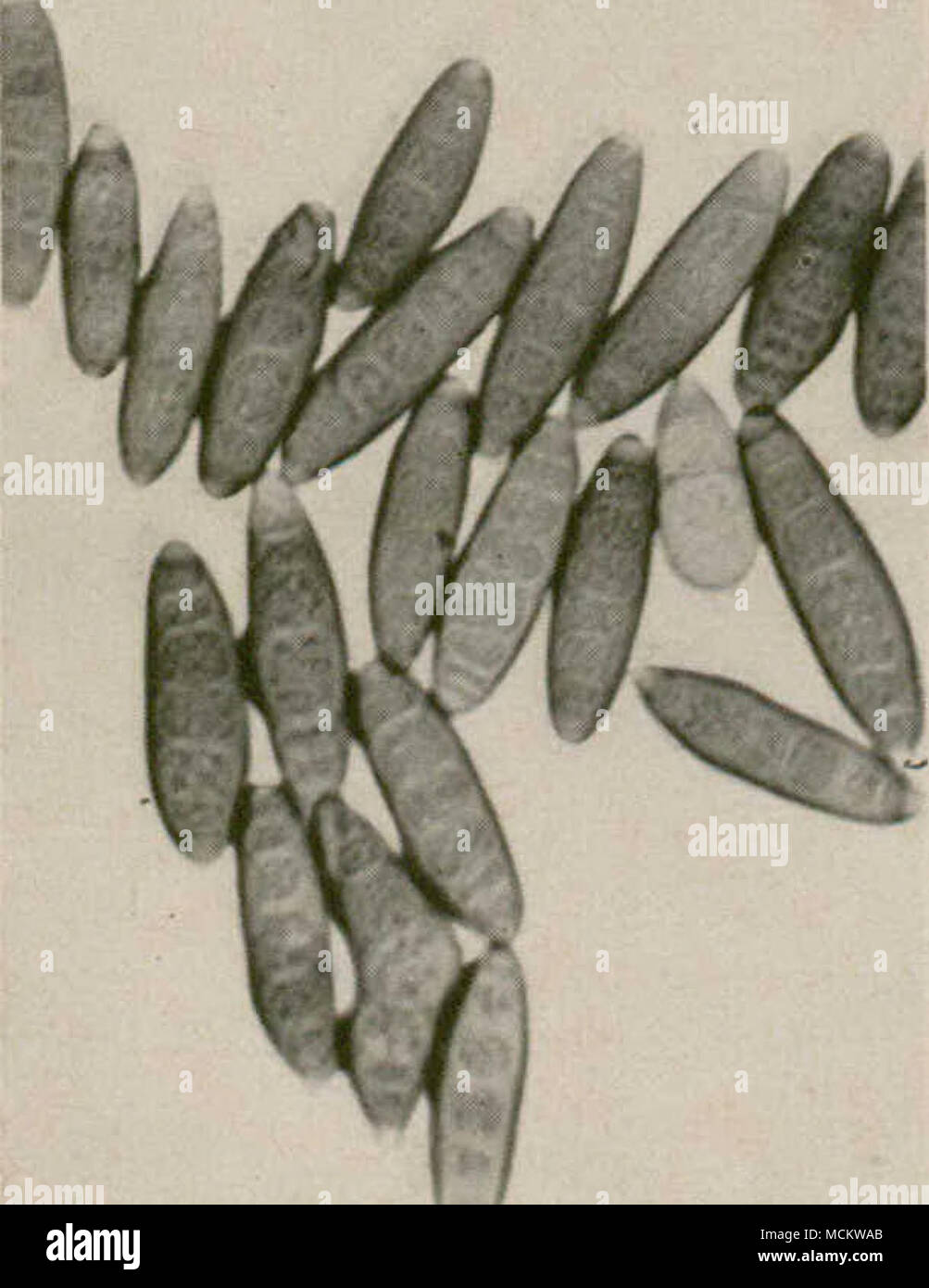 . Figure 3.—Spores of the fungus Helminthosporium .sativum. These spores infect stems, roots and leaves of wheat and barley. Helminthosporium sativum attacks chiefly the roots, the bases of stems, and the leaves of wheat and barley on which are produced its characteristic spores (Fig. 3). These spores survive the winter in the soil and on stubble and cause new infections the following spring. These are only a few examples of the great variety of devices by means of which the fungi adapt their parasitic existence to our growing crop plants. 10 Stock Photo