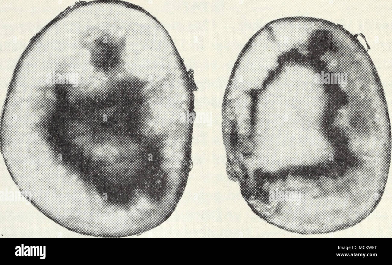 . Fig. 31.—Blackheart of potato. field, care being taken to remove and destroy any tubers which have formed. Seed treatment for other diseases like scab and rhizoctonia, to- gether with crop rotation, will help to control this. Dry Rot.—Potatoes in storage often show a dry, powdery or leathery type of decay which usually starts from bruises on the surface. High temperature and humidity and poor ventilation favor this, since these conditions are favorable to the fungus, a species of Fusariuni, which causes dry rot. Careful handling, cold-storage rooms at a temperature between 36° and 40° Fahren Stock Photo