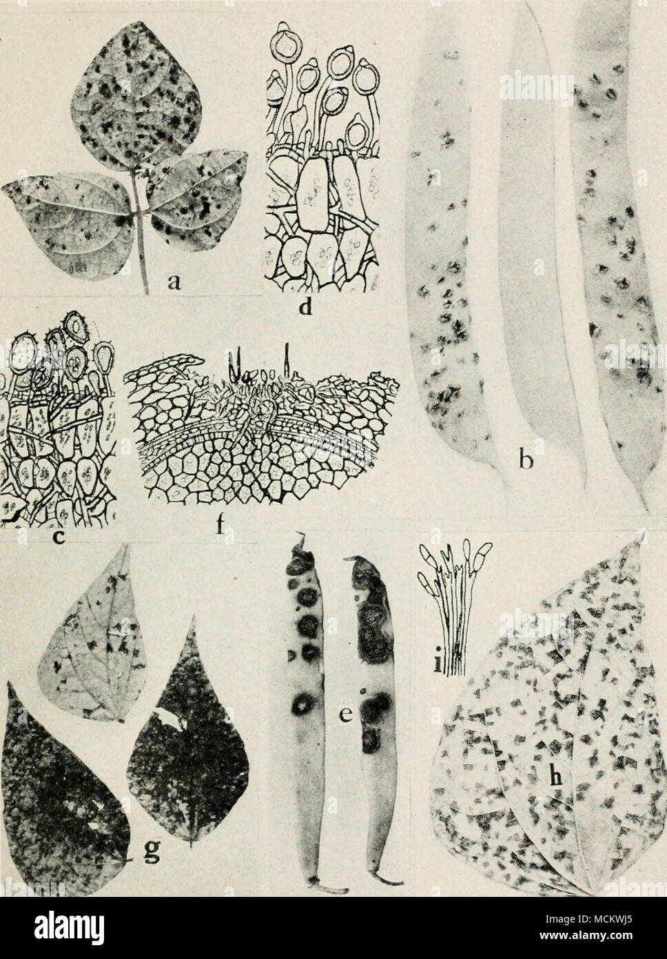 . Fig. 47. Bean Diseases. a. and b. Rust on leaf and pods, c. section through bean leaf showing bean rust, summer spores, d. section through bean leaf, showing bean rust, winter spores, e. anthracnose, /. section through bean seed, showing relation of anthracnose to the host (f. d. and /. after Whetzel), g. Cercospora leaf spot, h. Isariopsis griseola leaf spot, i. conidiophores and conidia of Isariopsis. Stock Photo