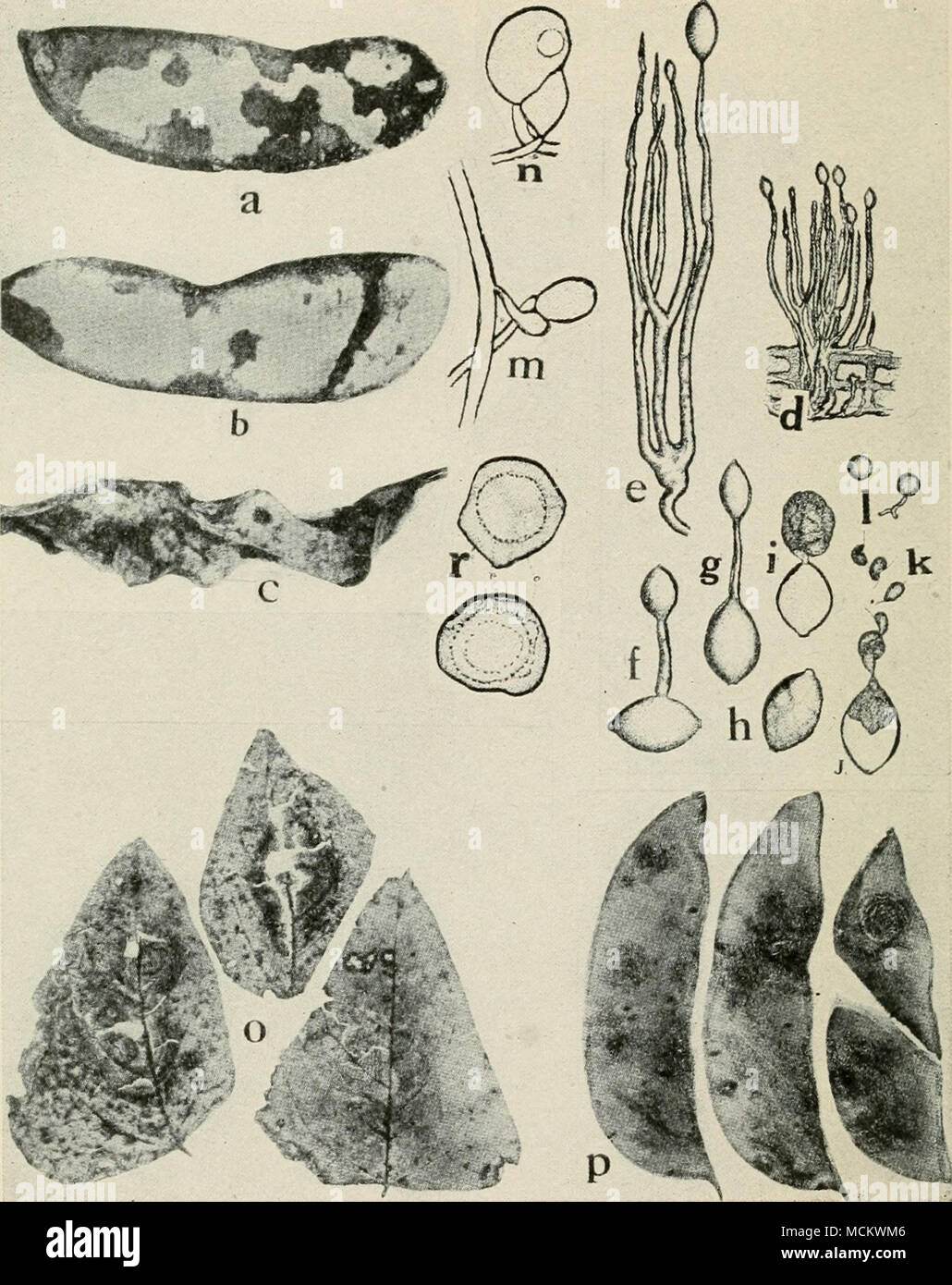 . Fig. 48. Diseases of Lima Bean. a. h. c. different stages of downy mildew on pods, d. tuft of conidiophores and conidia of Phythophthora phaseoli, e. same as d. but greatly enlarged, /. g. conidia germinating by means of a germ tube, h. i. j. k. germination of conidia by means of zoospores, /. germinating zoospores {d. to /. after Thaxter), m. n. fertilization of the oogonium by the antheridium, o. Phoma blight on foliage, p. Phoma blight on pods (o. and p. after Halsted), r. mature oospores of P. phaseoli {a. to c, m. n. and r. after Clinton). Stock Photo