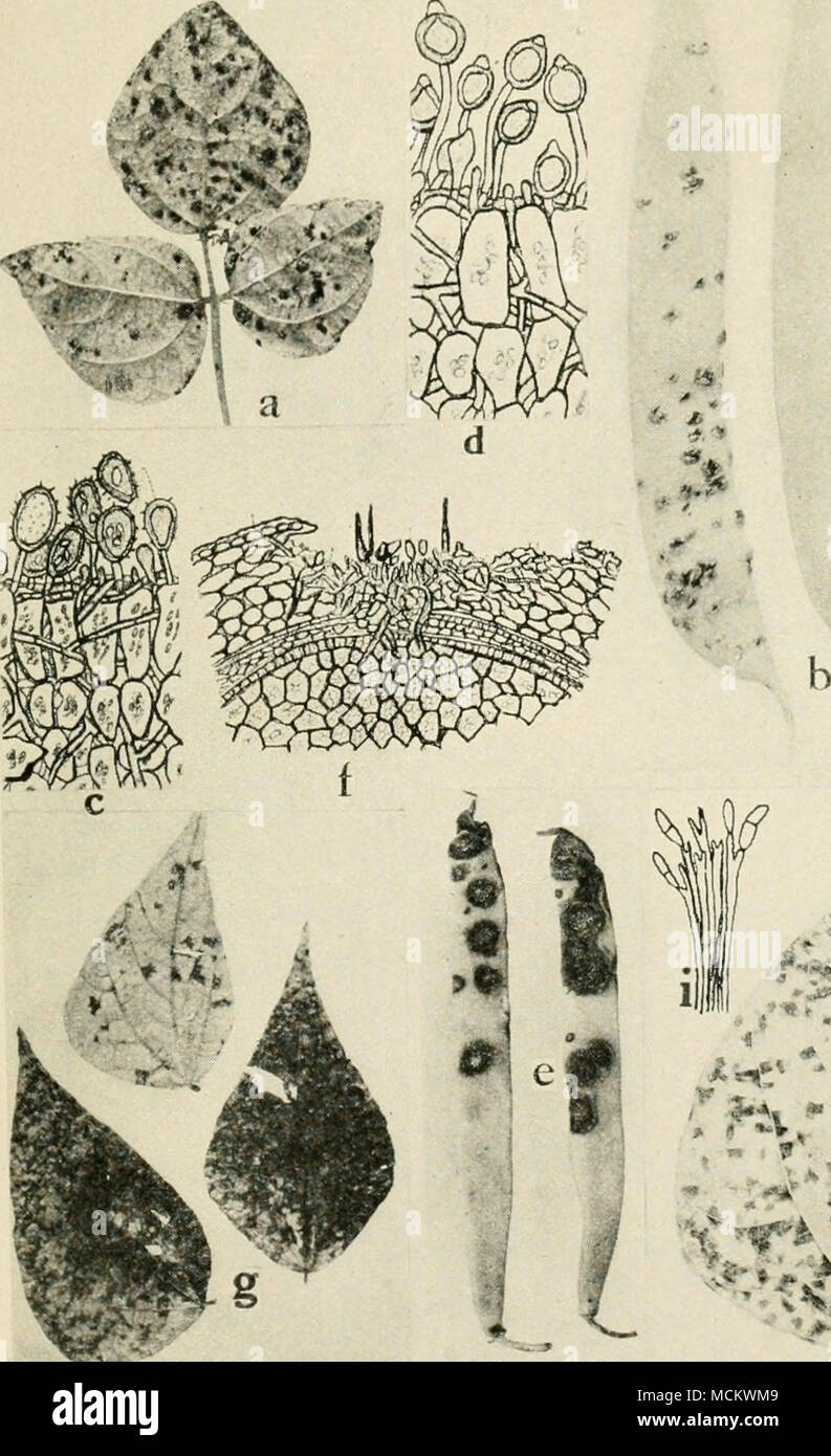 . ^ ^ ^C .,&quot;• • Fig. 47. Bean Diseases. a. and 6. Rust on leaf and pods. c. section through bean leaf showing bean rust, summer spores, d. section through bean leaf, showing bean rust, wmter spores f. anthracnose, /. section through bean seed, showing relation of anthracnose to the host (f. d. and/, after Whetzel), g. Cercospora leaf spot, h. Isariopsis ^riseola leat spot, i. conidiophores and conidia of Isariopsis. Stock Photo