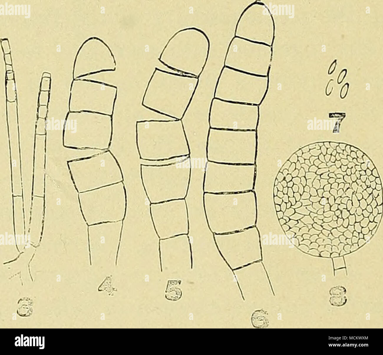 . Fig. 3. Endospores. Figs. 4, 5. Chlamydospores breaking up into individual spores. Fig. 6. Chlamydospores, unbroken. Fig. 7. Ascospores. Fig. 8. Ascus. spore case is formed on terminal branches. It has a somewhat swol- len base and a long tapering cell (Fig. 3). The endospores are form- ed in the apex of this terminal cell and are pushed out of the rup- tured end by the growth of the unfragmented protoplasm of the base. They are hyalin, thin-walled, oblong to linear 10-25ux4-5u. The second kind of spores formed are the chlamydospores (Figs. 4-6). These are thick-walled dark brown bodies, bor Stock Photo