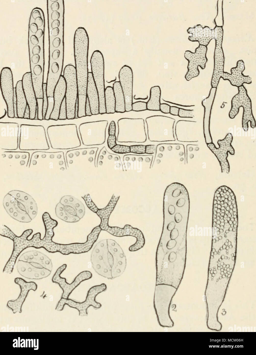 . Fig. 31. I, lixoascus deformans, sliowing asci in various stages of development burslinR through the cuticle of the leaf; 2, ascus of Exoanus pruni, showing stalk-cell at base of ascus, and eight spores; 3, ascus of Taphritia aiirca filled with secondary spores produced by budding of the ascospores ; 4, surface view of niycelium of Taphrina Sadcbcckii on leaf of Almes glutinosa ; 5, differentiation of fertile or ascogenous hyphae from vegetative hyphae of Tuphrina Sadebeckii. (Figs. 4 and 5 after Sadebcck.) All highly mag. upon. The asci at first contain eight spores, but in the majority of  Stock Photo