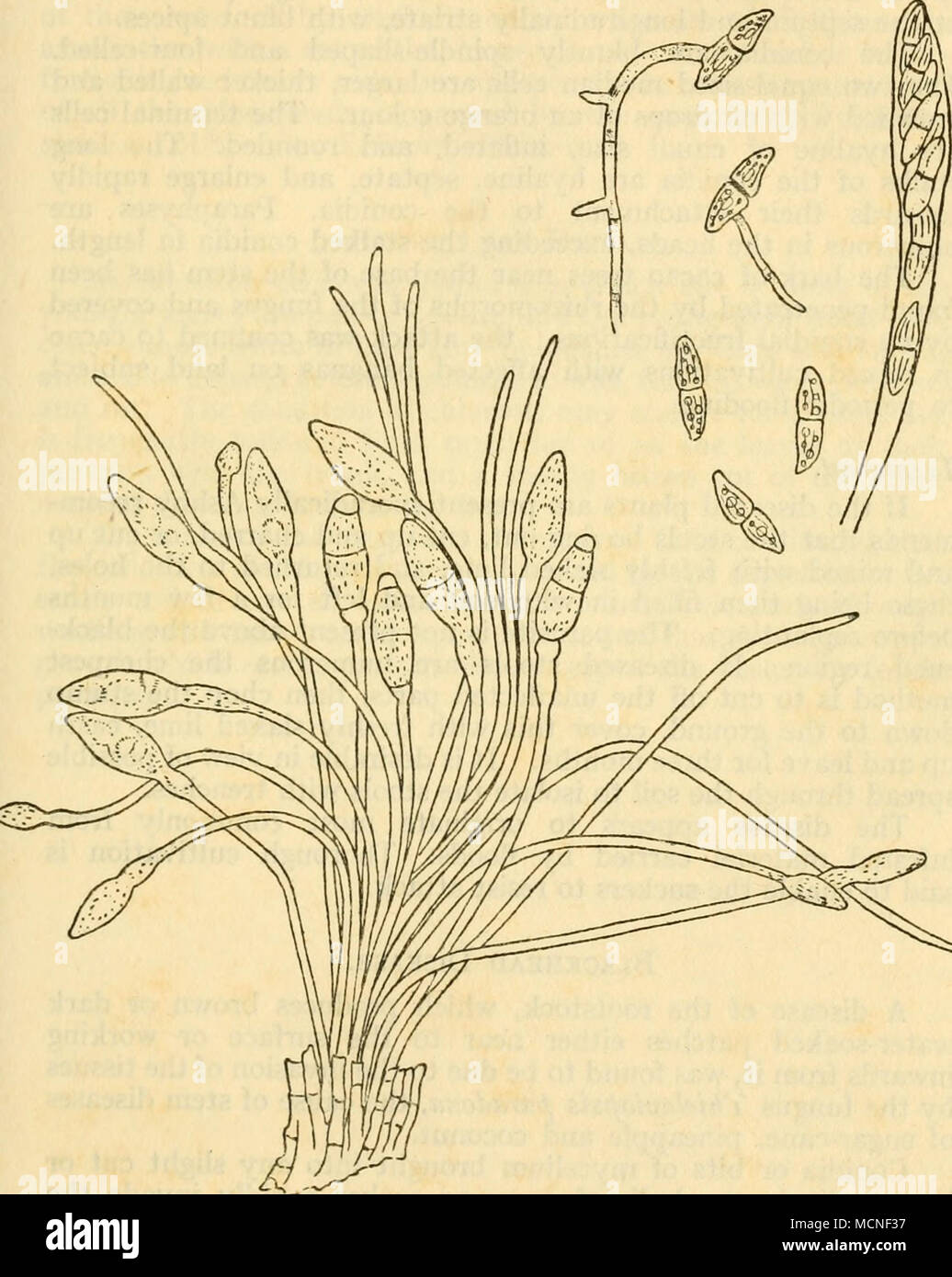 . Fig. 98 SpHAEROSTILBE MUSARUM, CONIDIA, ASCUS AND ASCOSPORES Bull. 6, Dept. Agri., Jamaica The conidial stage occurs on small yellow or orange cushions up to 2 mm. diameter, bearing one or more slender white stalks furnished with a brown or brownish red spherical head or ending in a point. Stock Photo