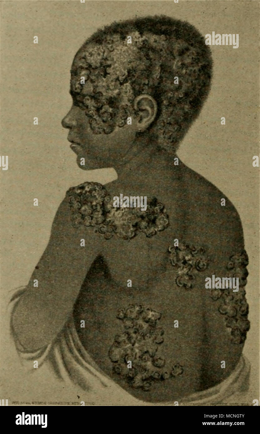 Hautkrankheiten mensch