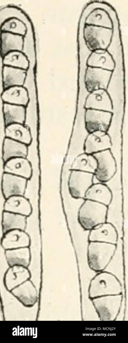 . ^^ Fig. 58.— Venturia inaequalis. i, conidial stage (Fusicladium dendriti- f«;«) on apple leaf; 2, 3 and 4, conidial stage; 6, section of perithecium ( Venturia stage) ; 7 and 8, asci and spores of Venturia ; 9, apple twig with Fusicladium stage, as appearing during winter and spring. Figs, i and 9 reduced ; remainder highly mag. practicable. I am not convinced. I believe that it is as practicable to remove the dead shoots from a tree as it is to remove the apples, in fact the Director of the Research Laboratory at Wisley informs me that, out of a batch of badly diseased apple-trees, those t Stock Photo