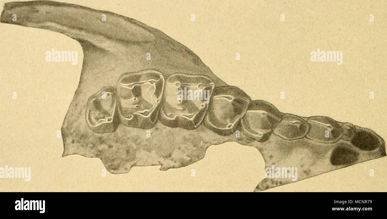 . Figur CCCV. Necrolemur aiiliquus Filliol var. major St. — Rechter Oberkiefer mit M3 —J. , (J3 V) luid Alveolus von -li (-Jj ?). — Pliosphorit von Larnagol, Basler Sammlung Q. H. 470. — Vi. Vordercontonr. Bei der Varietas major mögen beide Zähne sagittal eine Spur gedehnter sein als beim typischen Necrolemur autiquus, doch ist die Differenz sehr unbedeutend. Alle vier Kronenecken sind etwas abgerundet, am meisten die hintere Innenecke. Beide Zähne sind deutlich sechshüglig und stimmen auch in der Detail- structur nahe mit einander überein. Die beiden Aussenhügel, von denen der vordere den hin Stock Photo