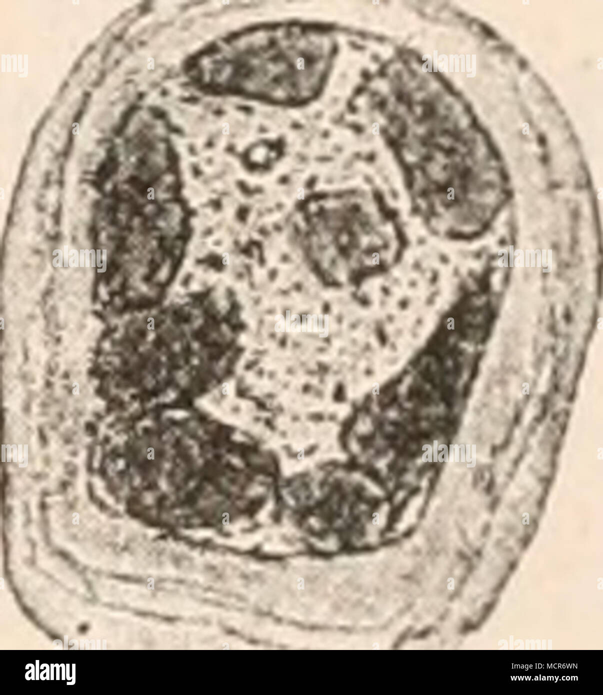 . Figur 11. Epithelioma molluscuin nach Neisser. 1. Querschnitt eines MoUuskumknotens bei scliwacher Vergrösserung. Die stark glänzenden, durch Horn- substanz zusammengehaltenen, fertigen ^loUuskum- körperchen (c) treten oben lieraus. 2. Körnige Schollen neben dem Kern der Epithelzelle, stark vergrösserl, aus Zone a. 3. u. 4. Isolirte glänzende Körper in den Zellen aus Zone b. Fixirungsmittel Sublimat, konzentrirte Lösung in physiologischer Kochsalzlösung benutzt wurde. Darauf folgte allmählich ansteigend Alkohol, von 90&quot;/o an mit Jodzusatz, Färbung im Stück, dann wiederum ansteigender Al Stock Photo