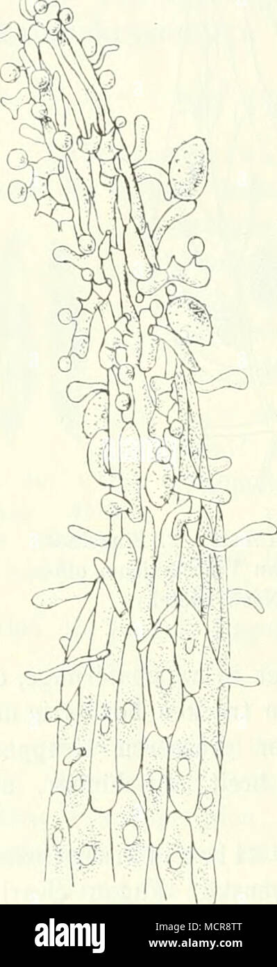 . Abb. 4e. Kill Teleutosporen- säillchen von Cronartium ribi- colum. Im oberen Teile kei- mende Telentosporen. Rechts oben einige angeklebte Uredo- sporen. (Nach Tiilasne.) Stock Photo
