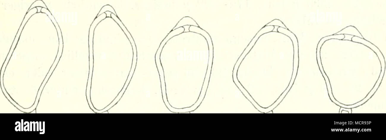 . W m^ mis mu 1(1 s Abb. 0. Teleutosporen von Uromyces Kabatianus von Geranium iii/renaici Aecidien blattunterseits auf rundlichen, gelblichen Flecken rundliche Gruppen bildend, zu wenigen dichtgedrängt Pseudoperidien halbkugelig, später löcher- förmig geöffnet. Pseudoperidieuzellen gleichmässig verdickt. Aecidiosporen kuglig oder polygonal und zwar eiförmig, ellipsoidisch oder länglich, orangegelb, 24—33 (i lang. 18—26'5 ^ breit, mit gelblicher, dicht- und feinwarziger Membran. Uredolagev blattunterseits auf gelben Flecken kreisförmig gruppiert, selten zerstreut, chokoladenbrann, staubig; Ure Stock Photo