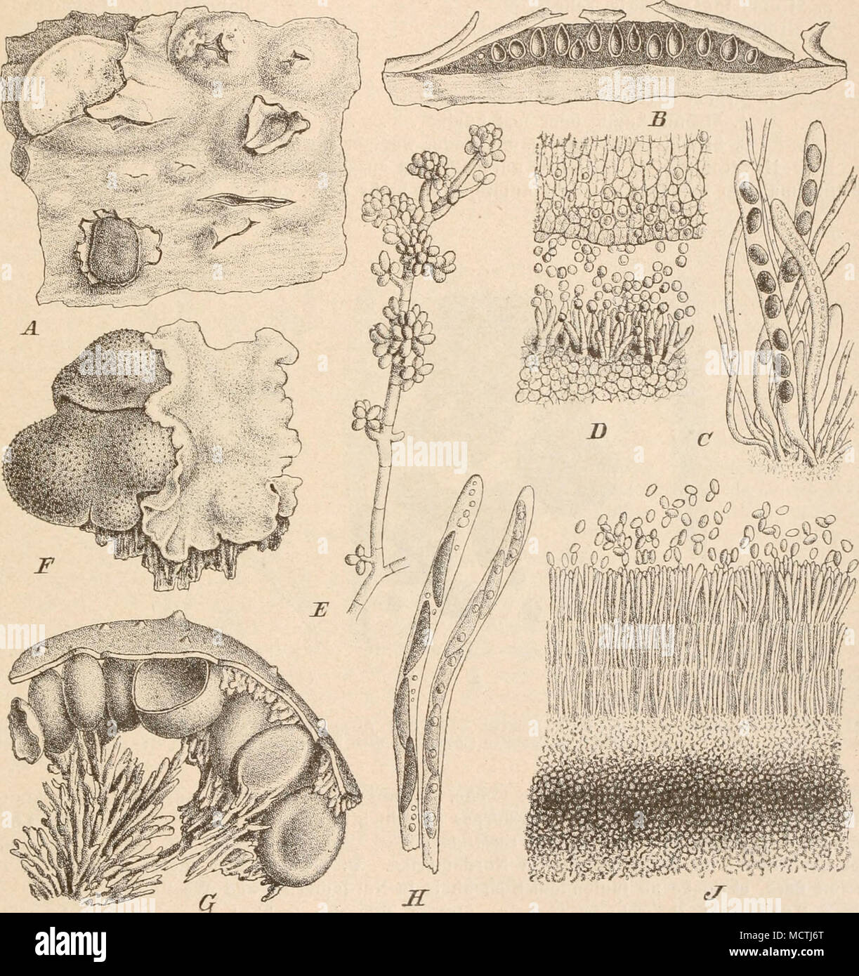 . Fig. 284. A—D Ntimmularia Bulliardi Tul. A Habitus, nat. Gr.; B Stroma im Längsschnitt (10/1); C Scliläuche (380/1); D Stück eines bedeckten Conidienlagers (:3S0|1). — E N. lataniicola Rehin, Conidienträger (:}50/]). — FJ üstuUna maxima (HaU.) Schrot. F Habitus; G abgebrochenes Stück eines Stromas (10)1); H Schläuche (ca. 380/1); J Stück eines Conidienlagers (ca. 380|1). (E nach Brefeld; das übrige nach Tulasne.) Über 200 Arten, deren Hauptverbreitungsgebiet in den Tropen liegt. In Mitteleuropa kommen etwa 25, in Nordamerika fast die 3fache Zahl der Arten vor. Nitschke gab auf Grund der Ges Stock Photo