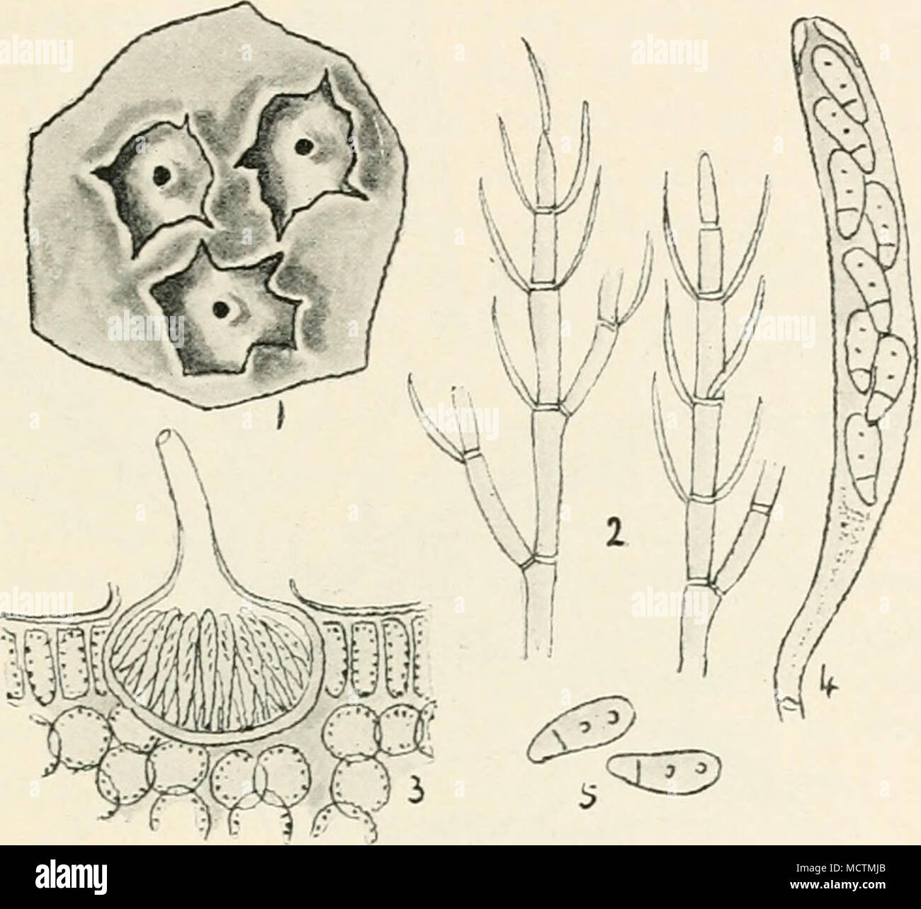 . Fig. 55.—Gnomonia erythrostoma. i, conceptacles containing spermatia bursting through the epidermis of a leaf; 2, spermatia ; 3, section of perithecium of ascospore stage ; 4, ascus containing spores ; 5, free spores. All mag. from one orchard to another. Frank records an instance in Prussia where the cherry industry was completely wrecked by this disease, but after two years' work in collecting and burn- ing all infected leaves, the epidemic was thoroughly stamped out, and a return to the former productiveness followed. Wild cherries growing in woods and the bird cherry {Friinus avium) are  Stock Photo