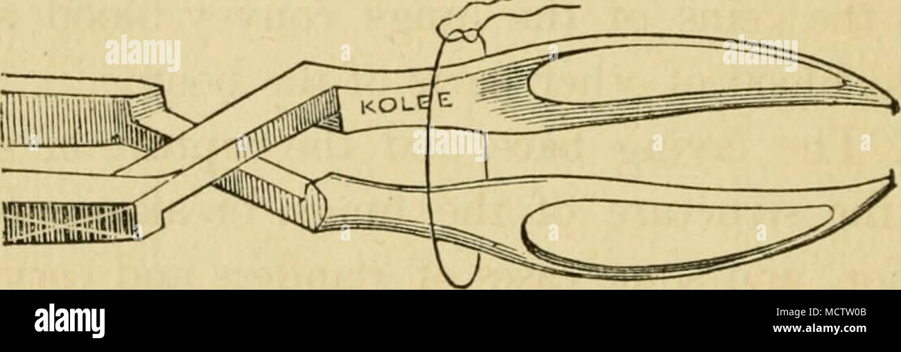 . ARTERY FORCEPS; SHOWING HOW A LIGATURE IS PASSED OVER TO TIE THE