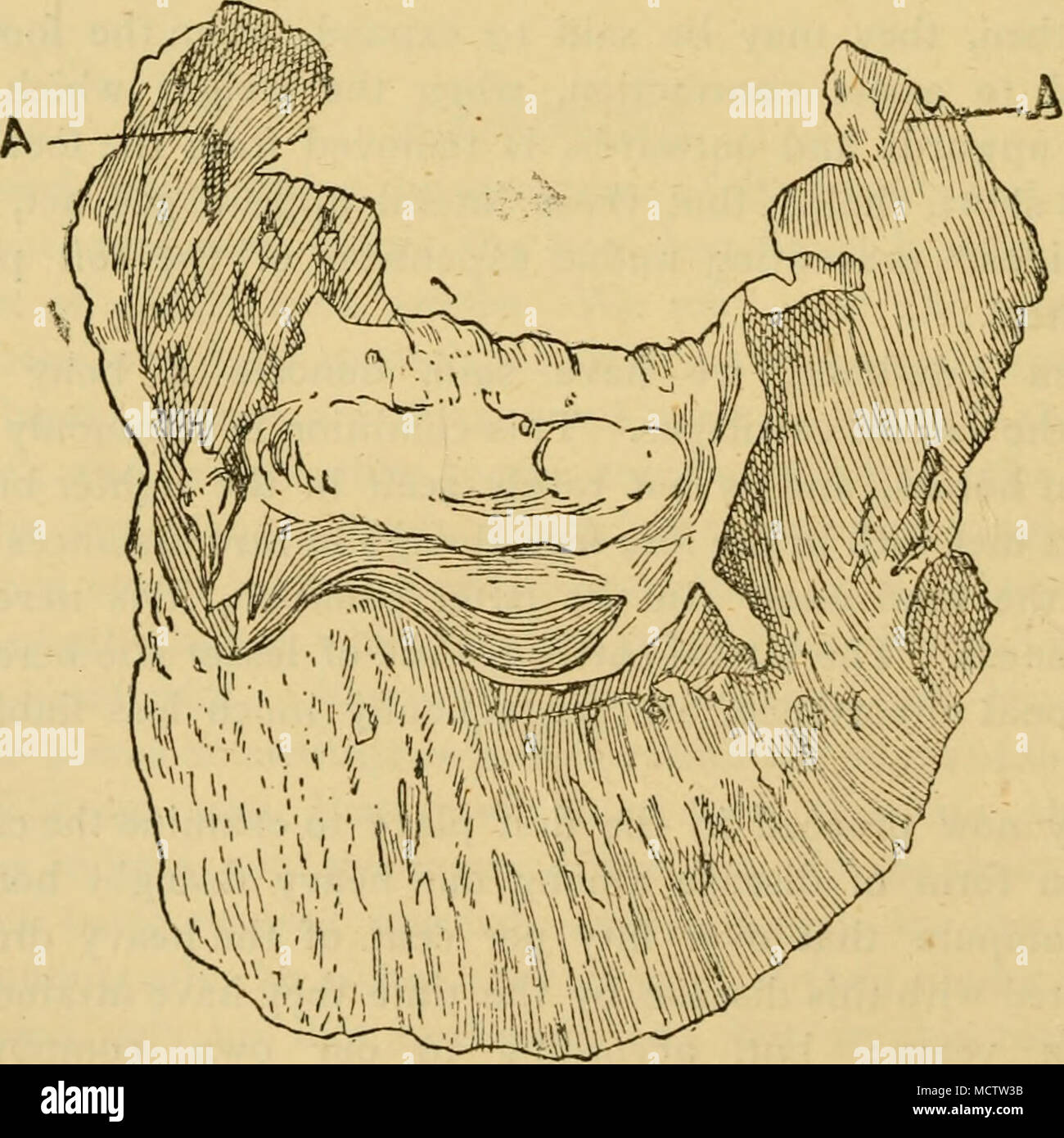 Pedal bone hires stock photography and images Alamy