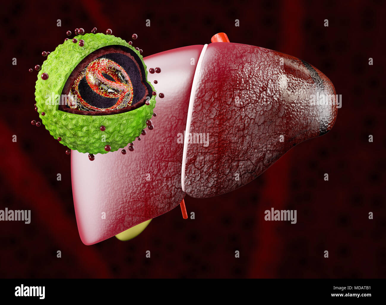 Liver with Hepatitis virus. Structure of the hepatitis B virus. 3d illustration Stock Photo Alamy