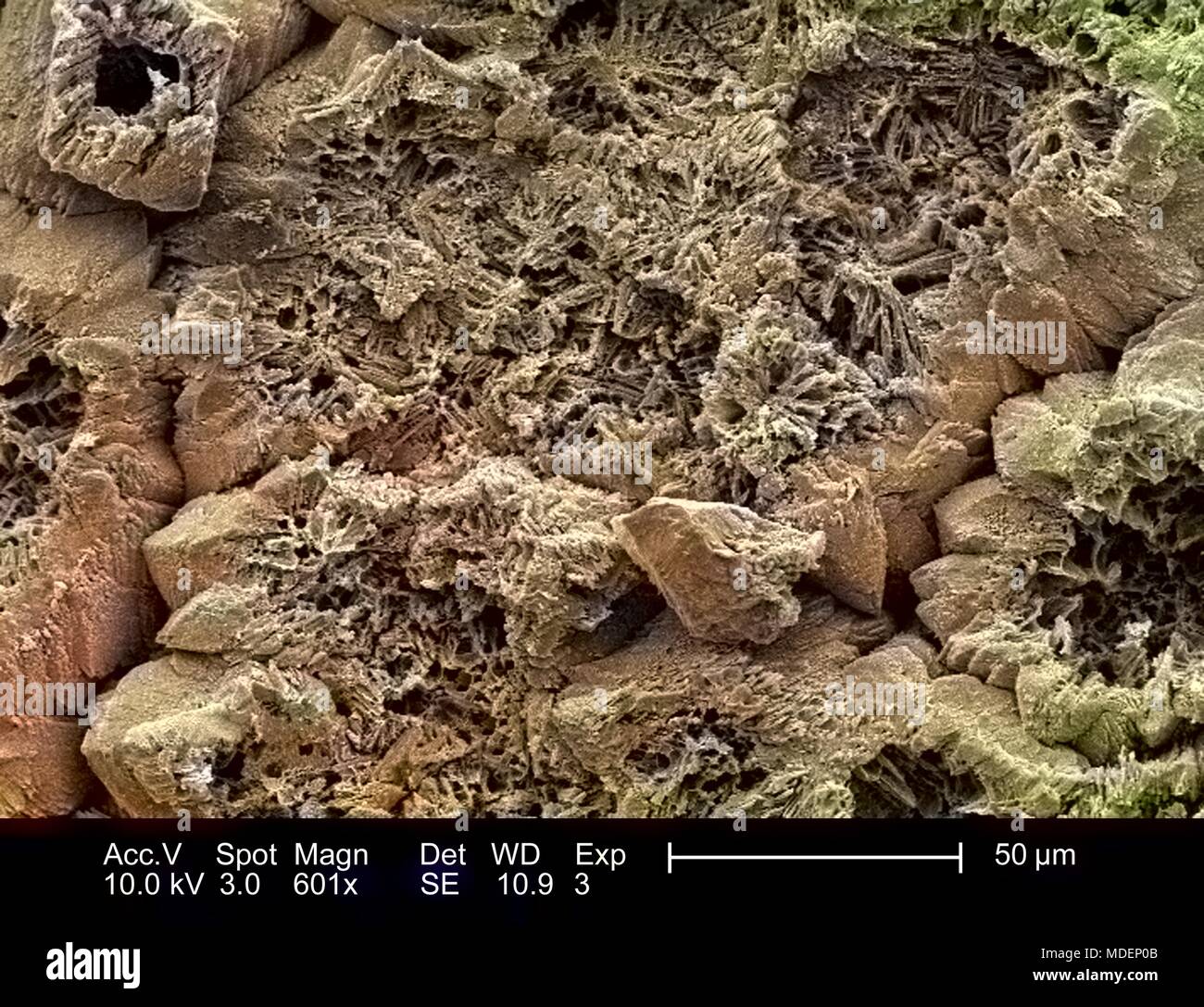 Morphologic characteristics of the inner surface of an unidentified ...