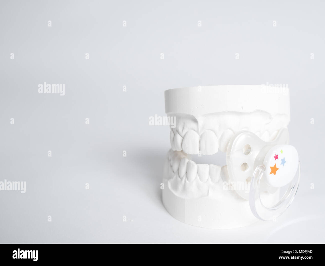 Minimizing the malocclusion caused by pacifiers, the gypsum tooth with