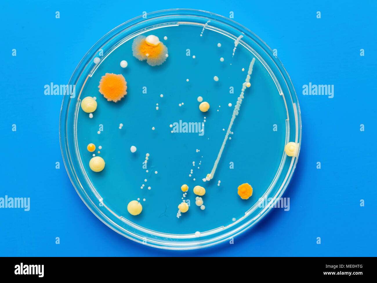 Petri Dish Bacteria Identification
