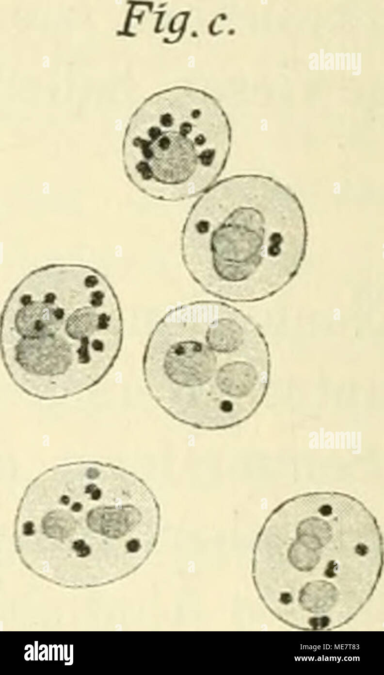 . Die mikroorganismen. Mit besonderer berÃ¼cksichtigung der Ã¤tiologie der infektionskrankheiten . Fig. 37. Diplokokkus intracellularis meningitidis. Nach Originalzeichmme von WeichselbäüM. man die Diplokokken auf der Oberfläche von Agar oder Glycerin-Agar, so bildet sich nach 48 Stunden ein massig üppiger, flacher, grauer Schleier von feinen, in maximo mohnkorngrossen Kolonien, die bei dichtem Zusammenstehen konfluieren. Auf Blutserum bildet sich ein kaum sichtbarer, sehr dünner und farbloser Belag von leicht körnigem Aussehen, der leicht übersehen werden kann. Auf der Agarplatte stellen sich Stock Photo