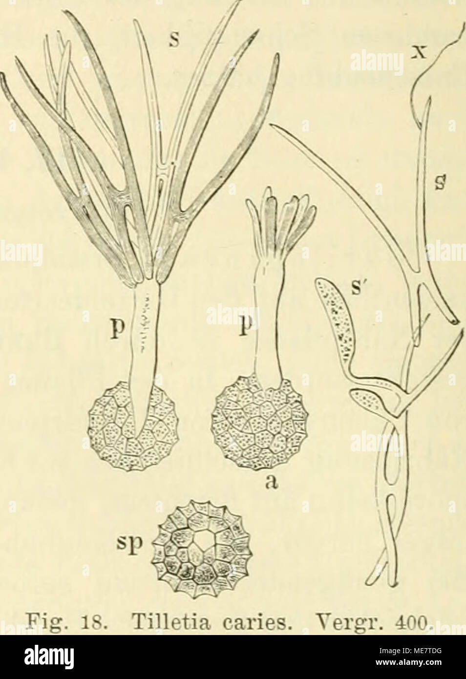 . Die Mit besonderer berücksichtigung der ätiologie