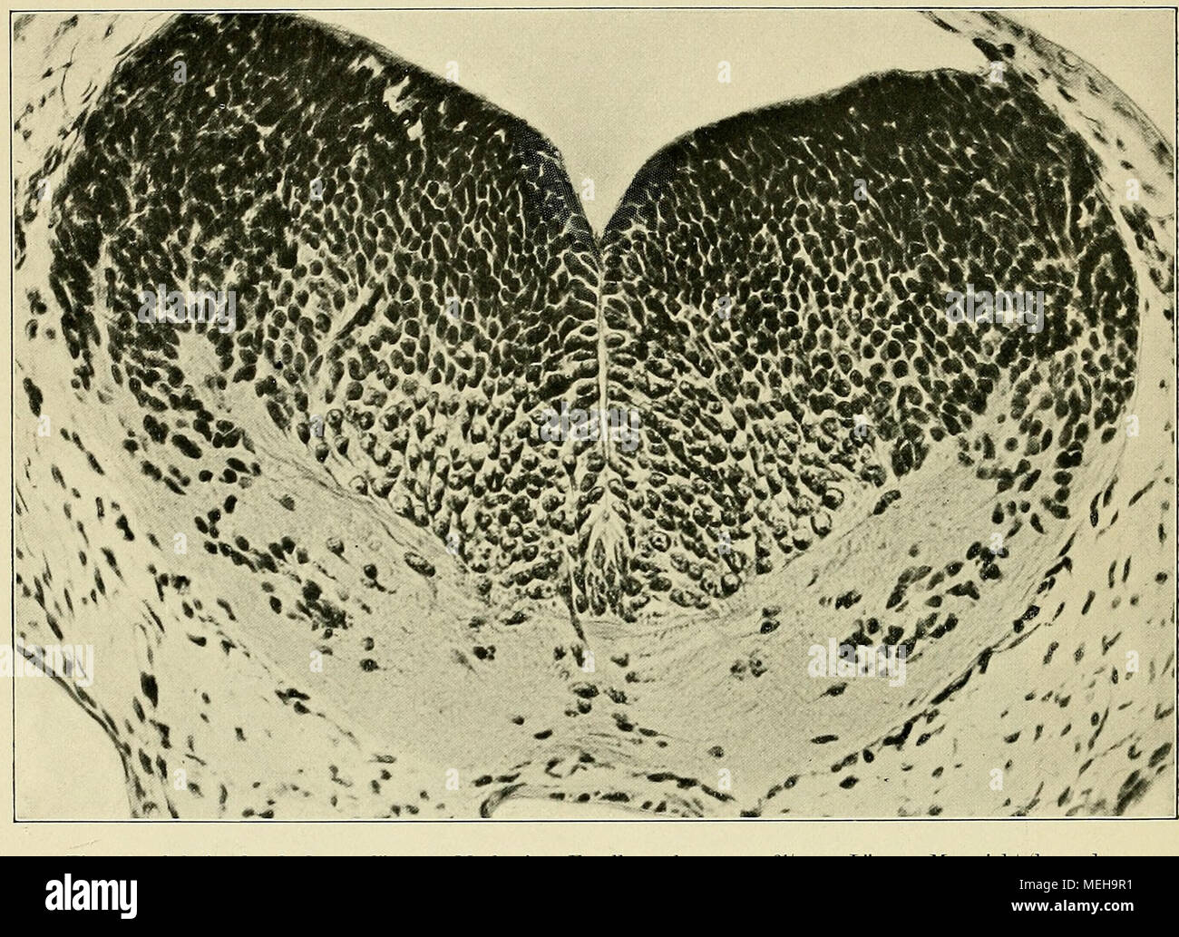 . Die Entwickelung des menschlichen Gehirns : während der ersten Monate : Untersuchungsergebnisse . Fig. 14. Schnitt durch das verlängerte Mark eines Forellenembryos von e'/j mm Länge. Man sieht (besonders links vom Beschauer) Scharen von Neuroblasten mit dunkeln Spitzen. (Zu Seite 23.) wiederkehrendes Bild ist das einer kornährenartigen Anordnung (Fig. 11, S. 19). Da, wo Neuroblasten zwischen vorhandenen Faserbündeln regellos zerstreut liegen, haben wir keinen Grund, sie als deren Ursprungszellen anzusehen. Ziemlich früh beginnt der Protoplasmaleib der Neuroblasten etwas anzuschwellen, und ge Stock Photo