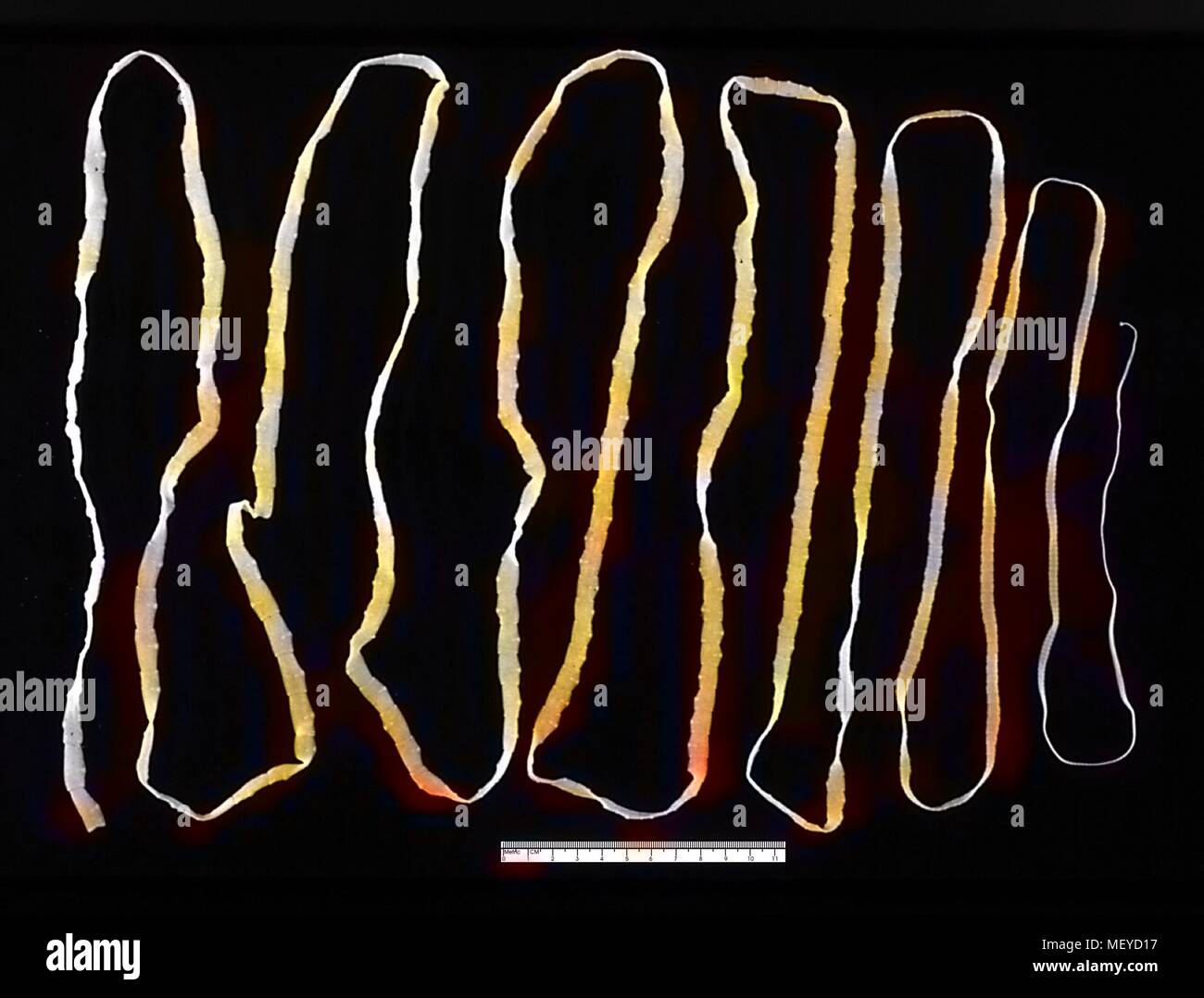 Adult tapeworm (Taenia saginata) in the human intestine, 1986. Image courtesy Centers for Disease Control (CDC). Note: Image has been digitally colorized using a modern process. Colors may not be period-accurate. () Stock Photo