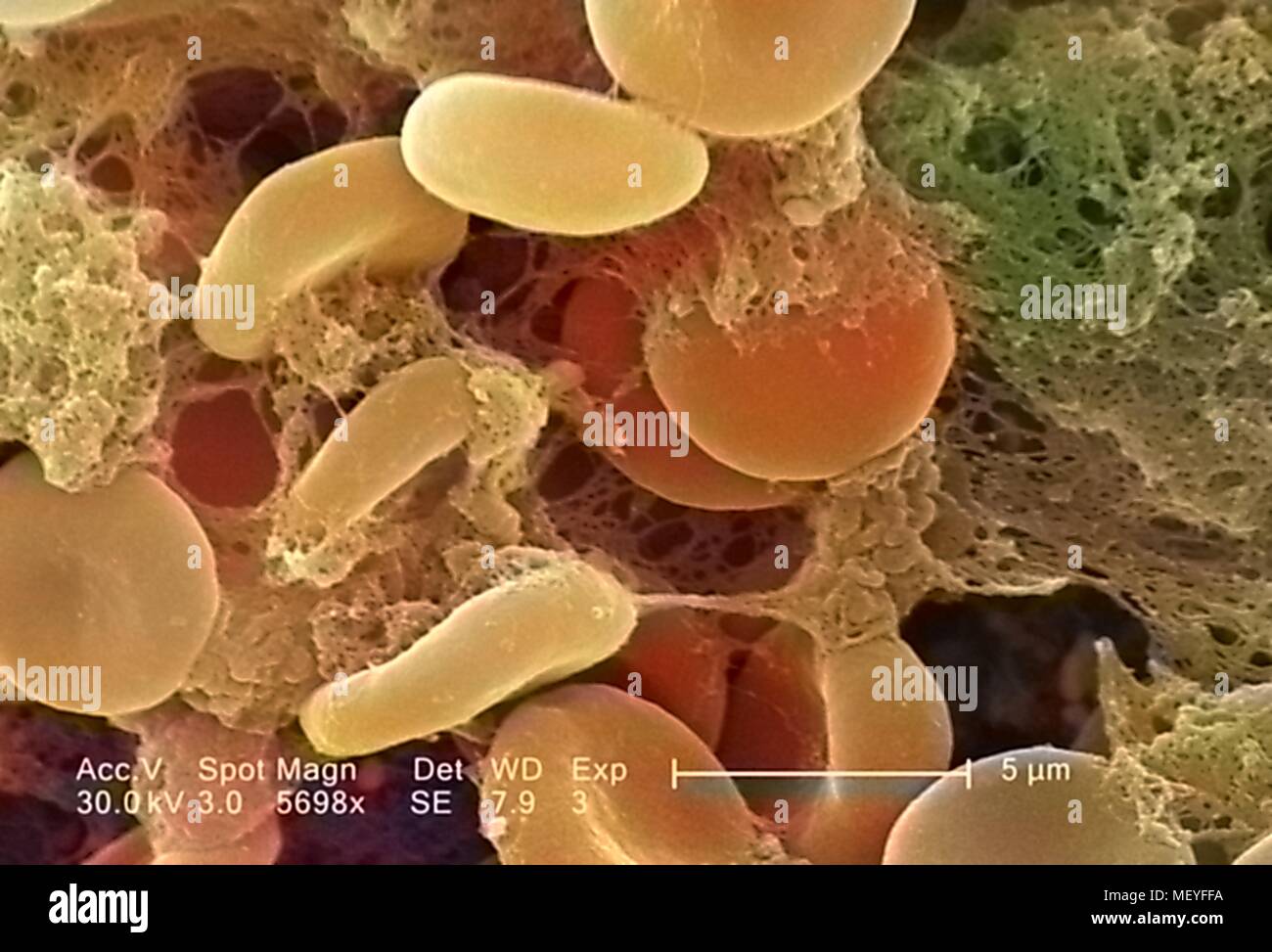 Red blood cell sem hi-res stock photography and images - Alamy