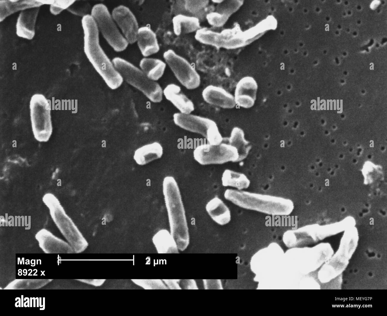 Segniliparus rotundus bacteria revealed in the 8922x magnified scanning electron microscopic (SEM) image, 2005. Image courtesy Centers for Disease Control (CDC) / Ray Butler, M.S. Janice Haney Carr. () Stock Photo