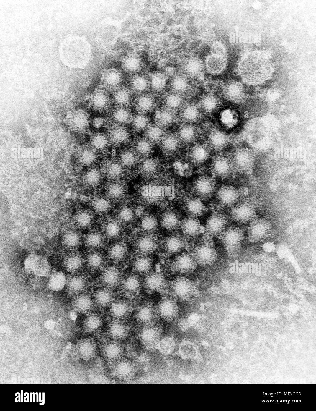 Hepatitis virions of an unknown strain of the organism revealed in the transmission electron microscopic (TEM) image, 1962. Image courtesy Centers for Disease Control (CDC) / E.H. Cook, Jr. () Stock Photo