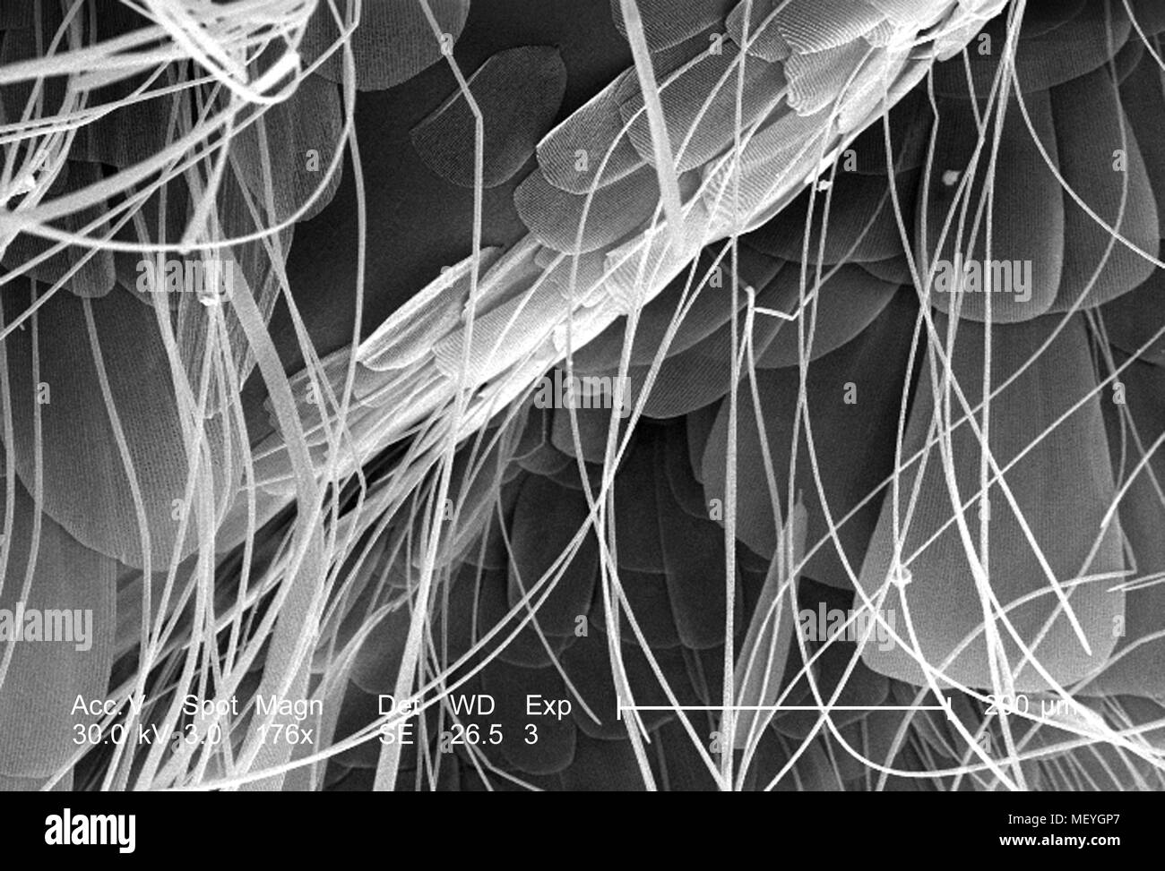 Exoskeletal body structures of an unidentified insect found in the Decatur, Georgia, revealed in the low magnified scanning electron microscopic (SEM) image, 2005. Image courtesy Centers for Disease Control (CDC) / Janice Haney Carr. () Stock Photo