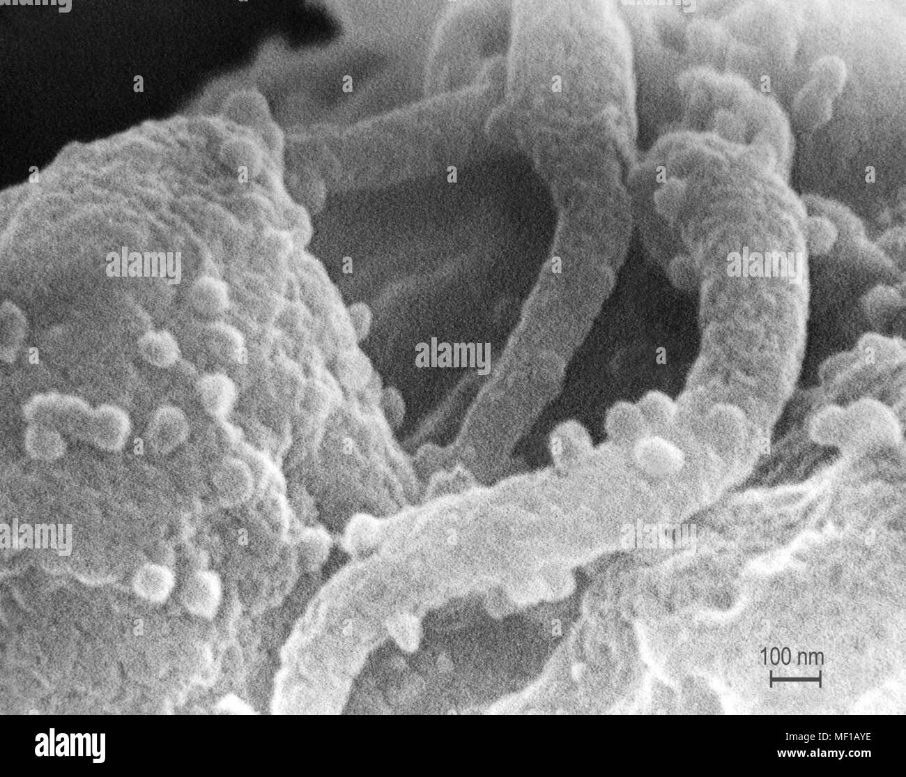 Presence of the human immunodeficiency virus (HIV-1) in a tissue sample, revealed in the highly magnified scanning electron microscopic (SEM) image, 1989. Image courtesy Centers for Disease Control (CDC) / C. Goldsmith, P. Feorino, E. L. Palmer, W. R. McManus. () Stock Photo