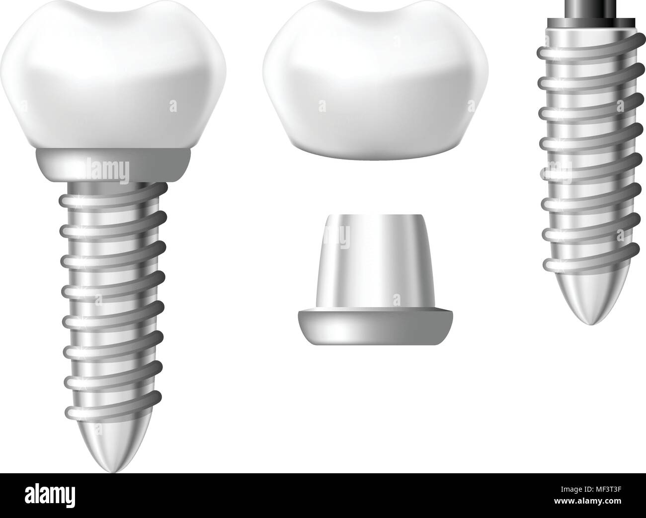 Dental implant component parts tooth denture components Stock Vector