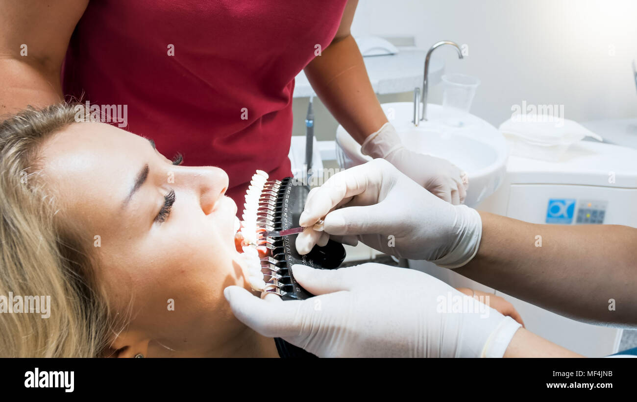 Closeup photo of dentist checking patient teeth color wtih special chart Stock Photo