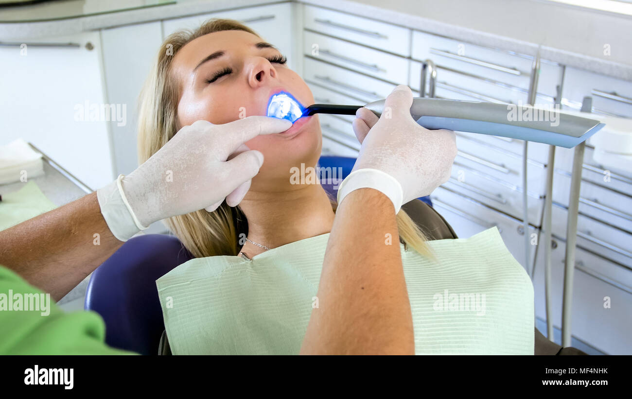 Dentist using dental curing UV light lamp for treatment Stock Photo Alamy