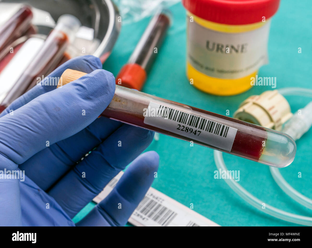 Doctor holds blood sample at a hospital table, conceptual image Stock Photo