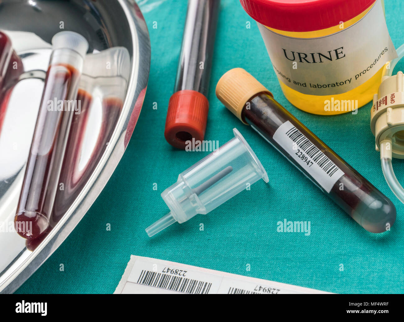 Urine and blood samples at a hospital table, conceptual image Stock