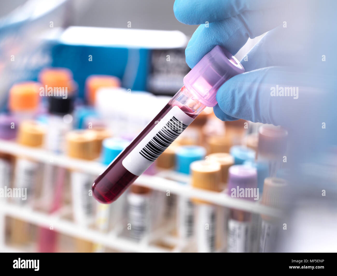 Medical technician preparing a human blood sample for clinical testing Stock Photo