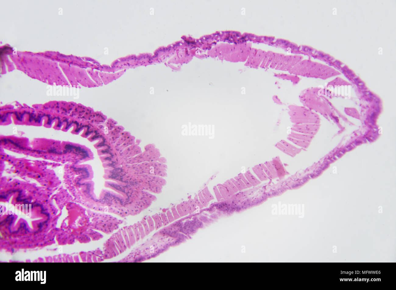 Microscopic photography. Earthworm, transversal section. Stock Photo