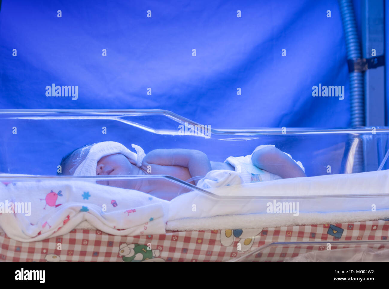 Newborn under the ultraviolet lamp. Child baby having a treatment for ...