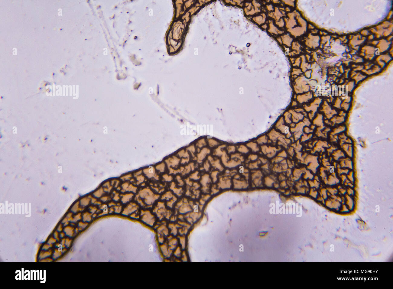 Congealed blood cells under the microscope Stock Photo Alamy