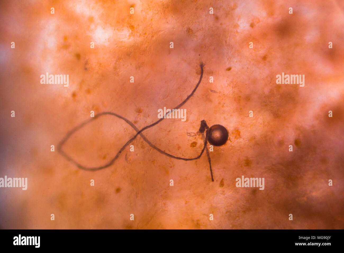 Bacteria under the microscope Stock Photo Alamy